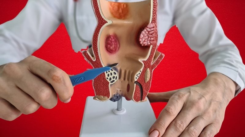 Proctologia